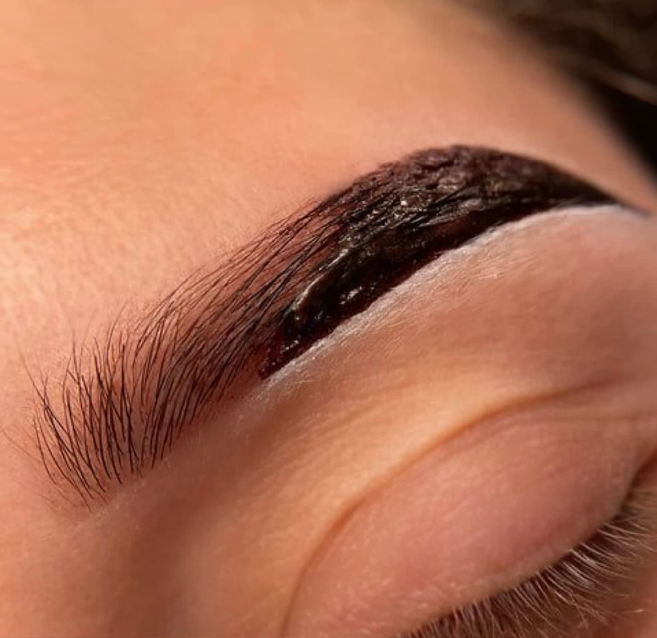 Hybrid brows procedure