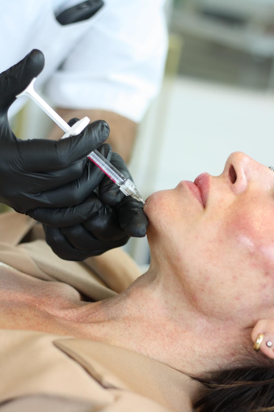 Kin filler voordelen